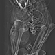 Imagen para el artículo titulado Descubren la sádica muerte de un faraón egipcio tras un nuevo estudio de su cuerpo momificado